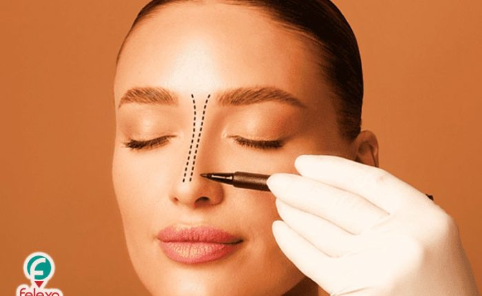 تجميل الانف