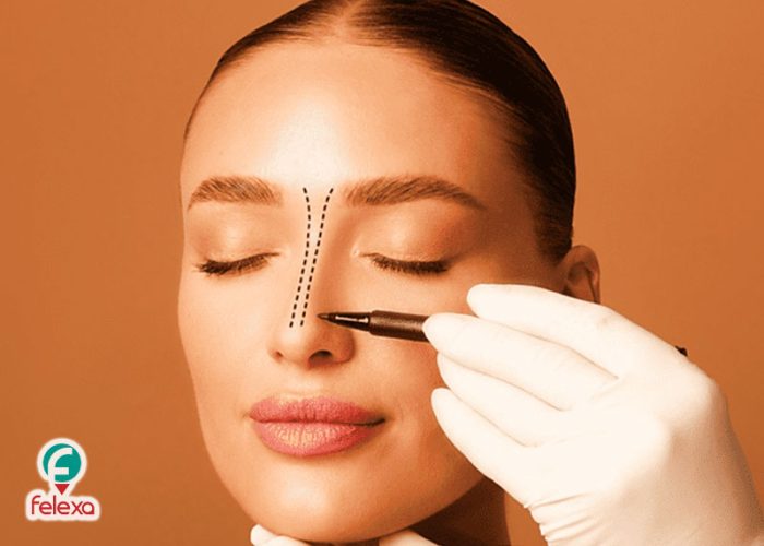 تجميل الانف